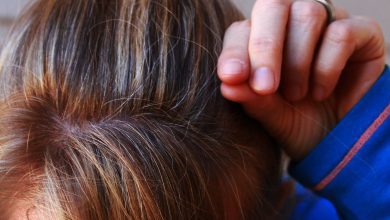 10 Surprising Factors that Change Your Hair and Scalp including Hair Loss and How Hair and Scalp Age? 5 an image of hair and scalp