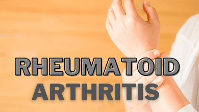 Rheumatoid Arthritis & Its Little-Known Effects on Personality. 1 Rheumatoid arthritis