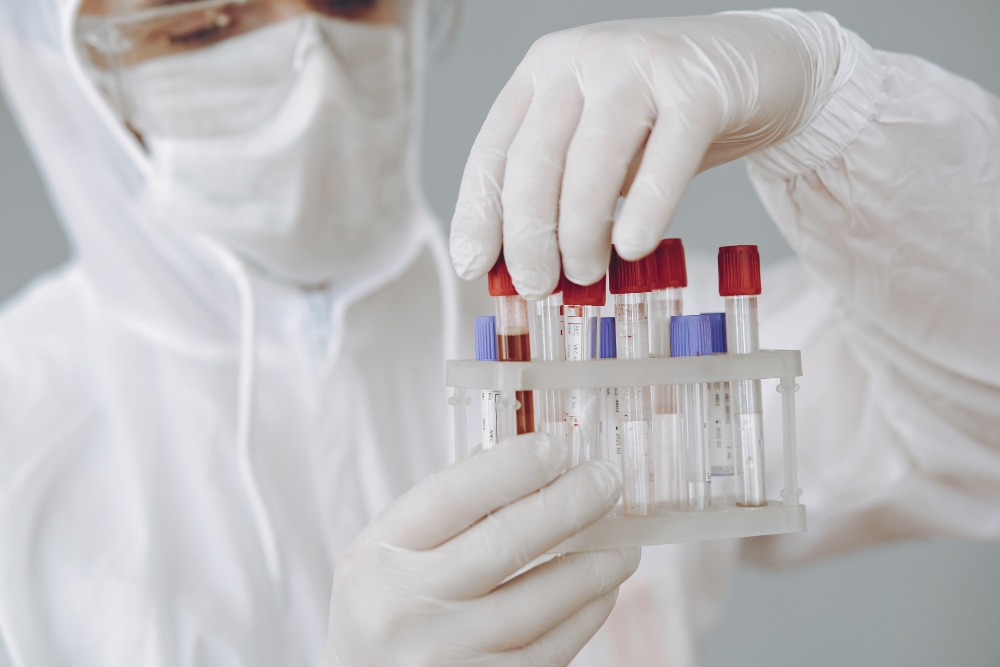 What Is a Complete Blood Test? When Do We Need Them? 1 blood test