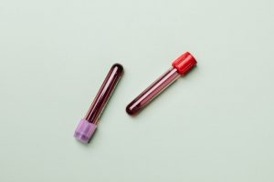 What Is a Complete Blood Test? When Do We Need Them? 2 blood testing