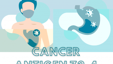 What Can a Cancer Antigen 72-4 Detect? A Complete Breakthrough 5 Cancer Antigen 72-4