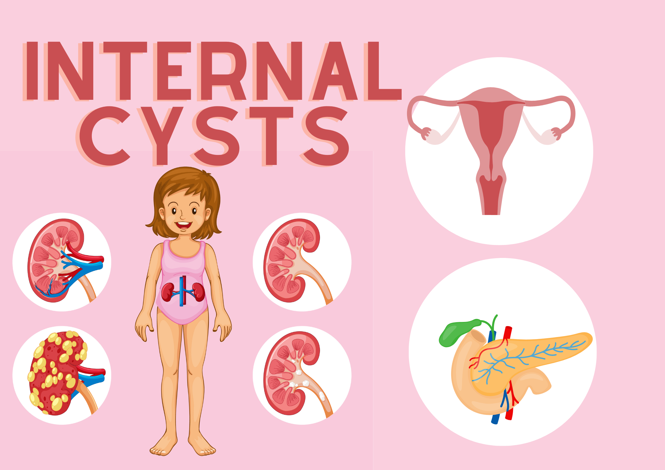 The Top 5 Internal Cysts & Thier Research Based Treatments. 1 Internal Cysts