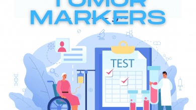 Tumor Markers. How Do They Help in Cancer Diagnosis? 4 Tumor Markers