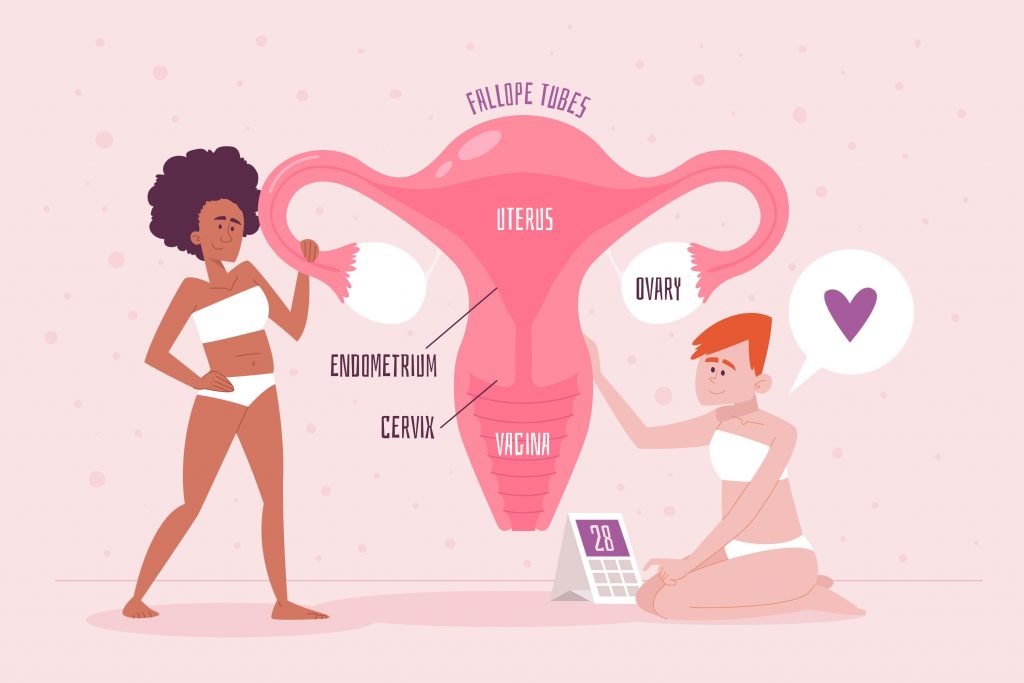 PCOS 