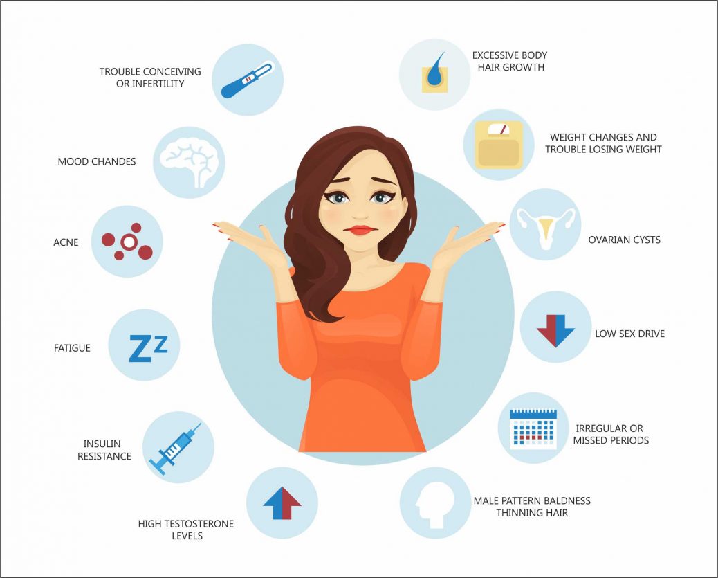 PCOS Symptoms min 1038x835 1