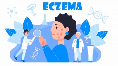 Eczema