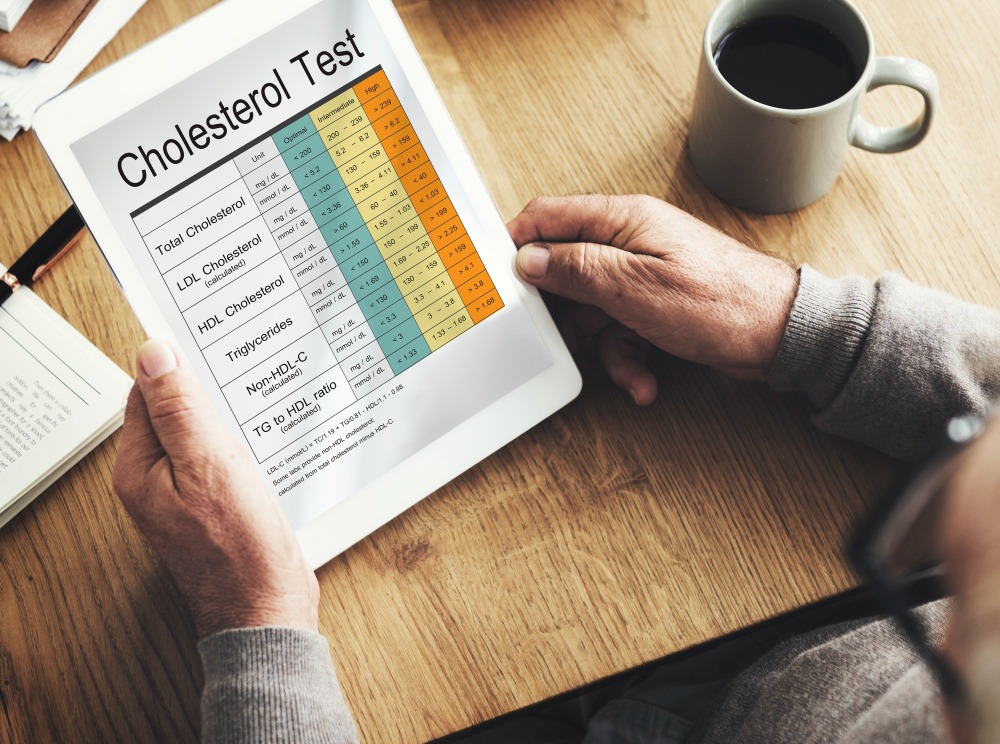 Why is Cholesterol Important for Human body? Some facts. 1 blood-cholesterol-report-test-healthcare
