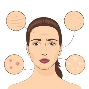Facial Aging Explained. The Top 8 Aging Changes Proven By Researches. 3 Facial aging
