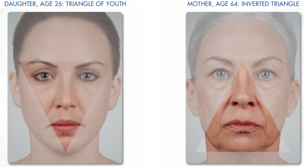Facial Aging Explained. The Top 8 Aging Changes Proven By Researches. 2 trainagle of youth in facial aging