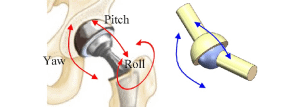A Comprehensive Guide on Joint Replacement Surgery. 3 joint