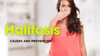 Halitosis-Insights from Medical Research and How Can We Prevent It? 1 halitosis