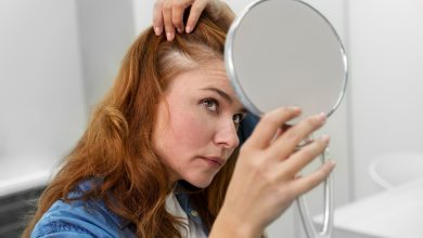 hair loss