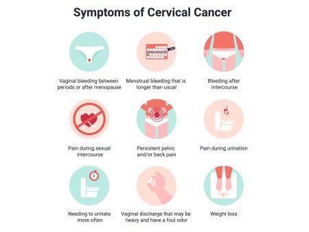 Image of symptoms of cervical cancer