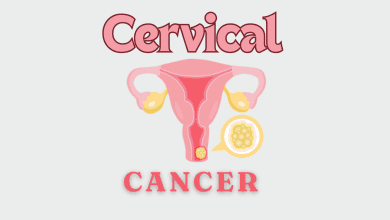 Understanding Cervical Cancer. An informative Guide for Risk Factors and Symptoms. 6 cervical cancer
